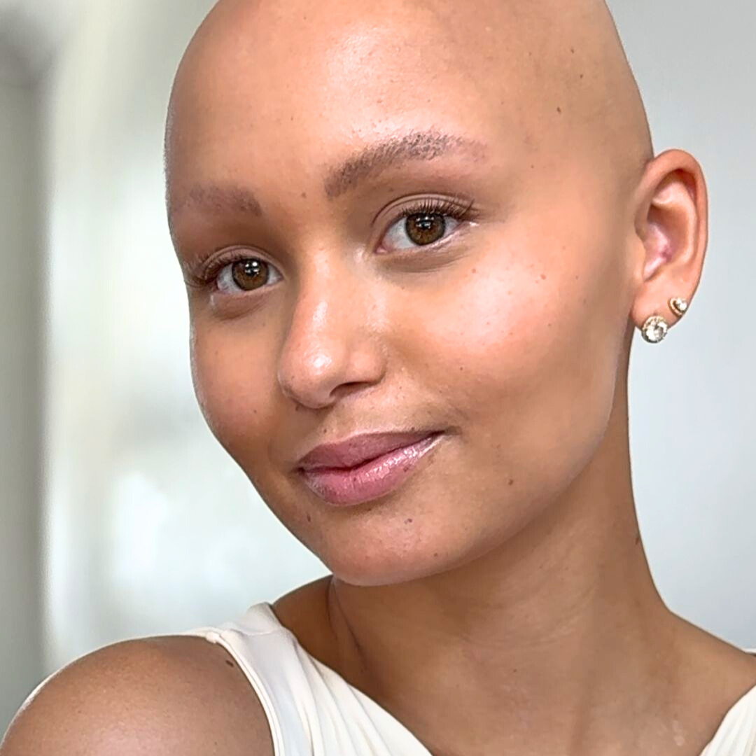 Close-up of a person with a bald head wearing a white sleeveless top.